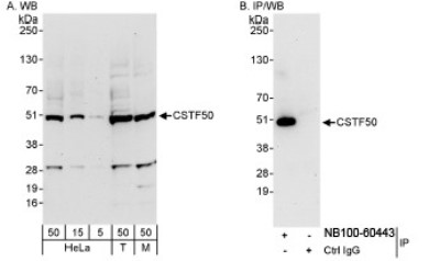 Western Blot: cleavage stimulation factor Antibody [NB100-60443] - Whole cell lysate from HeLa (5, 15 and 50 ug for WB; 1 mg for IP, 20% of IP loaded), 293T (T; 50 ug), and mouse NIH3T3 (M; 50 ug) cells.  NB100-60443 used for WB at 0.4 ug/ml (A) and 1 ug/ml (B). CSTF50 was immunoprecipitated by rabbit anti-CSTF50 antibody NB100-60444, which recognizes a downstream epitope.