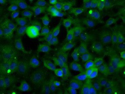 Immunocytochemistry/Immunofluorescence: SH3PX1 Antibody (1B5) [NBP2-02609] - Immunofluorescent staining of HeLa cells using anti-SH3PX1 mouse monoclonal antibody.