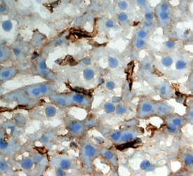 CLEC4F/CLECSF13 was detected in perfusion fixed frozen sections of mouse liver using Rat Anti-Mouse CLEC4F/CLECSF13 Monoclonal Antibody (Catalog # MAB2784) at 5 µg/mL overnight at 4 °C. Tissue was stained using the Anti-Rat HRP-DAB Cell & Tissue Staining Kit (brown; Catalog # CTS017) and counterstained with hematoxylin (blue). Specific staining was localized to Kupffer cells. View our protocol for Chromogenic IHC Staining of Frozen Tissue Sections.