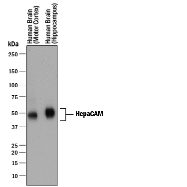 Western blot shows lysates of human brain (motor cortex) tissue and human brain (hippocampus) tissue. PVDF membrane was probed with 1 µg/mL of Sheep Anti-Human HepaCAM Antigen Affinity-purified Polyclonal Antibody (Catalog # AF4108) followed by HRP-conjugated Anti-Sheep IgG Secondary Antibody (Catalog # HAF016). A specific band was detected for HepaCAM at approximately 45-70 kDa (as indicated). This experiment was conducted under reducing conditions and using Immunoblot Buffer Group 1.