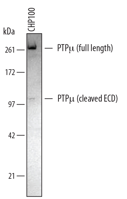 Western blot shows lysates of HepG2 human hepatocellular carcinoma cell line, and CHP‑100 human neuroblastoma cell line. PVDF membrane was probed with 1 µg/mL of Mouse Anti-Human/Mouse/Rat PTPμ/PTPRM Monoclonal Antibody (Catalog # MAB4446) followed by HRP-conjugated Anti-Mouse IgG Secondary Antibody (Catalog # HAF007). A specific band was detected for PTPμ/PTPRM at approximately 280 kDa (as indicated). This experiment was conducted under reducing conditions and using Immunoblot Buffer Group 1.