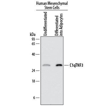 Western blot shows lysates of human mesenchymal stem cells either undifferentiated or differentiated into adipocytes. PVDF membrane was probed with 1 µg/mL of Sheep Anti-Human CTRP3/C1qTNF3/CORS26 Antigen Affinity-purified Polyclonal Antibody (Catalog # AF7925) followed by HRP-conjugated Anti-Sheep IgG Secondary Antibody (Catalog # HAF016). A specific band was detected for CTRP3/C1qTNF3/CORS26 at approximately 28 kDa (as indicated). This experiment was conducted under reducing conditions and using Immunoblot Buffer Group 1.