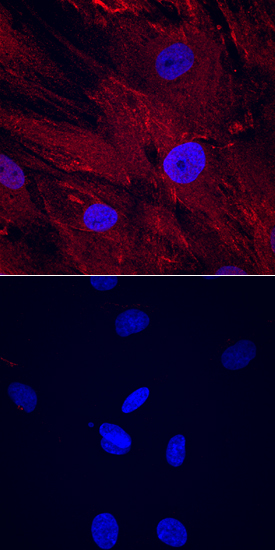 CTRP3/C1qTNF3/CORS26 was detected in immersion fixed human mesenchymal stem cells differentiated (upper panel) or not (lower panel) into adipocytes using Sheep Anti-Human CTRP3/C1qTNF3/CORS26 Antigen Affinity-purified Polyclonal Antibody (Catalog # AF7925) at 10 µg/mL for 3 hours at room temperature. Cells were stained using the NorthernLights™ 557-conjugated Anti-Sheep IgG Secondary Antibody (red; Catalog # NL010) and counterstained with DAPI (blue. Specific staining was localized to cytoplasm. View our protocol for Fluorescent ICC Staining of Cells on Coverslips.