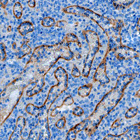 Stabilin‑2 was detected in immersion fixed paraffin-embedded sections of human spleen using Mouse Anti-Human Stabilin‑2 Monoclonal Antibody (Catalog # MAB3645) at 15 µg/mL overnight at 4 °C. Tissue was stained using the Anti-Mouse HRP-DAB Cell & Tissue Staining Kit (brown; Catalog # CTS002) and counterstained with hematoxylin (blue). Specific staining was localized to epithelial cells. View our protocol for Chromogenic IHC Staining of Paraffin-embedded Tissue Sections.