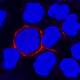 CD300f/LMIR3 was detected in immersion fixed human peripheral blood mononuclear cells (PBMCs) using Rat Anti-Human CD300f/LMIR3 Monoclonal Antibody (Catalog # MAB2774) at 15 µg/mL for 3 hours at room temperature. Cells were stained using the NorthernLights™ 557-conjugated Anti-Rat IgG Secondary Antibody (red; Catalog # NL013) and counterstained with DAPI (blue). Specific staining was localized to cell surfaces. View our protocol for Fluorescent ICC Staining of Non-adherent Cells.