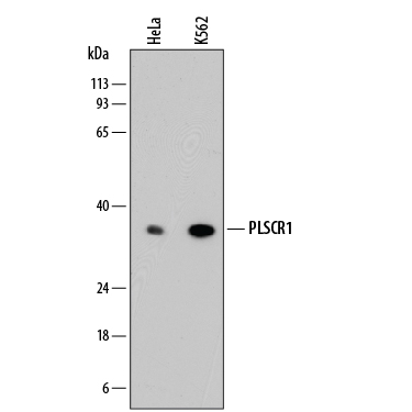Western blot shows lysates of HeLa human cervical epithelial carcinoma cell line and K562 human chronic myelogenous leukemia cell line. PVDF membrane was probed with 1 µg/mL of Mouse Anti-Human Phospholipid Scramblase 1/PLSCR1 Monoclonal Antibody (Catalog # MAB8137) followed by HRP-conjugated Anti-Mouse IgG Secondary Antibody (Catalog # HAF018). A specific band was detected for Phospholipid Scramblase 1/PLSCR1 at approximately 37 kDa (as indicated). This experiment was conducted under reducing conditions and using Immunoblot Buffer Group 1.