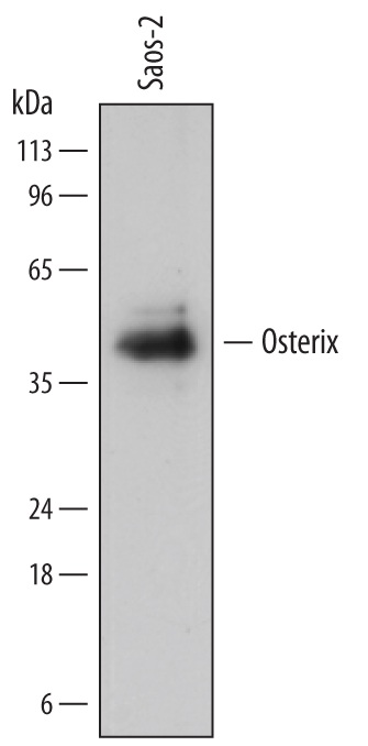 Western blot shows lysates of Saos‑2 human osteosarcoma cell line. PVDF membrane was probed with 1 µg/mL of Mouse Anti-Human Osterix/Sp7 Monoclonal Antibody (Catalog # MAB7547) followed by HRP-conjugated Anti-Mouse IgG Secondary Antibody (Catalog # HAF018). A specific band was detected for Osterix/Sp7 at approximately 45 kDa (as indicated). This experiment was conducted under reducing conditions and using Immunoblot Buffer Group 1.