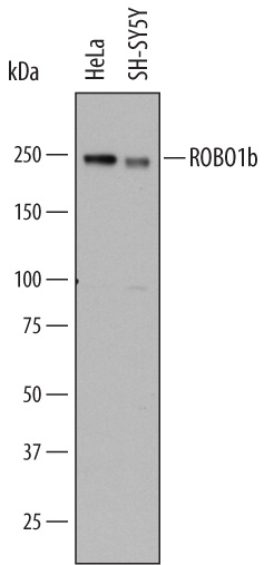 Western blot shows lysates of HeLa human cervical epithelial carcinoma cell line and SH‑SY5Y human neuroblastoma cell line. PVDF membrane was probed with 2 µg/mL of Mouse Anti-Human ROBO1 Monoclonal Antibody (Catalog # MAB7118) followed by HRP-conjugated Anti-Mouse IgG Secondary Antibody (Catalog # HAF007). A specific band was detected for ROBO1 at approximately 220 kDa (as indicated). This experiment was conducted under reducing conditions and using Immunoblot Buffer Group 1.