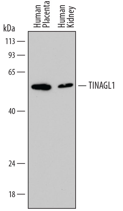 Western blot shows lysates of human placenta tissue and human kidney tissue. PVDF membrane was probed with 0.5 µg/mL of Mouse Anti-Human TINAGL1 Monoclonal Antibody (Catalog # MAB7185) followed by HRP-conjugated Anti-Mouse IgG Secondary Antibody (Catalog # HAF018). A specific band was detected for TINAGL1 at approximately 55 kDa (as indicated). This experiment was conducted under reducing conditions and using Immunoblot Buffer Group 1.