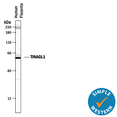 Simple Western lane view shows lysates of human placenta tissue, loaded at 0.5 mg/mL. A specific band was detected for TINAGL1 at approximately 59 kDa (as indicated) using 5 µg/mL of Mouse Anti-Human TINAGL1 Monoclonal Antibody (Catalog # MAB7185). This experiment was conducted under reducing conditions and using the 12-230 kDa separation system. Non-specific interaction with the 230 kDa Simple Western standard may be seen with this antibody.
