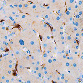 Stabilin‑1 was detected in immersion fixed paraffin-embedded sections of human liver using Mouse Anti-Human Stabilin‑1 Monoclonal Antibody (Catalog # MAB3825) at 15 µg/mL overnight at 4 °C. Before incubation with the primary antibody, tissue was subjected to heat-induced epitope retrieval using Antigen Retrieval Reagent-Basic (Catalog # CTS013). Tissue was stained using the Anti-Mouse HRP-DAB Cell & Tissue Staining Kit (brown; Catalog # CTS002) and counterstained with hematoxylin (blue). Specific staining was localized to endothelial cells in bile canaliculi. View our protocol for Chromogenic IHC Staining of Paraffin-embedded Tissue Sections.