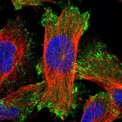 Immunocytochemistry/Immunofluorescence: ELKS Antibody [NBP1-88179] - Staining of human cell line U-251 MG shows positivity in plasma membrane & focal adhesion sites.