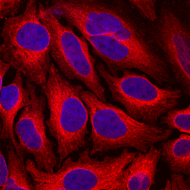 Endoglycan/PODXL2  was detected in immersion fixed HeLa human cervical epithelial carcinoma cell  line using Mouse Anti-Human Endoglycan/PODXL2 Monoclonal Antibody (Catalog #  MAB1524) at 10 µg/mL for 3 hours at room temperature.  Cells were stained using the NorthernLights™ 557-conjugated  Anti-Mouse IgG Secondary Antibody (red; Catalog # NL007)  and counterstained with DAPI (blue). Specific staining was localized to  cytoplasm. View our protocol for Fluorescent  ICC Staining of Cells on Coverslips.
