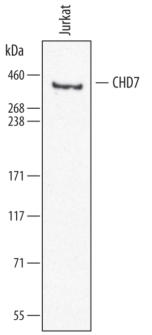 Western blot shows lysates of Jurkat human acute T cell leukemia cell line. PVDF membrane was probed with 0.5 µg/mL of Sheep Anti-Human CHD7 Antigen Affinity-purified Polyclonal Antibody (Catalog # AF7350) followed by HRP-conjugated Anti-Sheep IgG Secondary Antibody (Catalog # HAF016). A specific band was detected for CHD7 at approximately 350 kDa (as indicated). This experiment was conducted under reducing conditions and using Immunoblot Buffer Group 8.