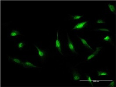 Immunocytochemistry/Immunofluorescence: TIP120A Antibody (1G5) [H00055832-M05] - Analysis of monoclonal antibody to CAND1 on HeLa cell. Antibody concentration 10 ug/ml