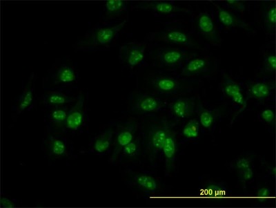 Immunocytochemistry/Immunofluorescence: C1D Antibody (6H2) [H00010438-M03] - Analysis of monoclonal antibody to C1D on HeLa cell. Antibody concentration 10 ug/ml