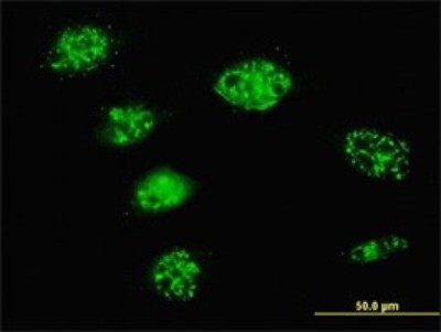 Immunocytochemistry/Immunofluorescence: SMARCD3 Antibody (1G6) [H00006604-M01] - Analysis of monoclonal antibody to SMARCD3 on HeLa cell. Antibody concentration 10 ug/ml.