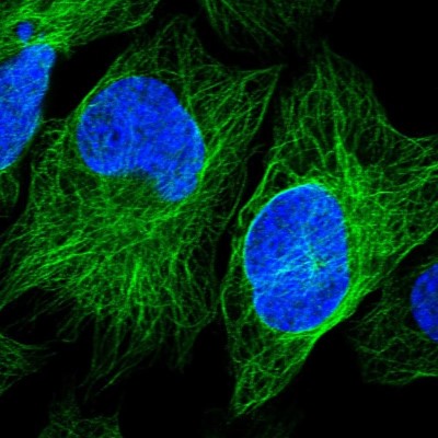 Immunocytochemistry/Immunofluorescence: SRPX2 Antibody [NBP1-86999] - Immunofluorescent staining of human cell line U-2 OS shows localization to microtubules.