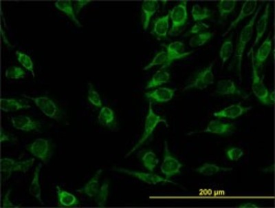 Immunocytochemistry/Immunofluorescence: C21orf33 Antibody (1F5) [H00008209-M01] - Analysis of monoclonal antibody to C21orf33 on HeLa cell. Antibody concentration 10 ug/ml.