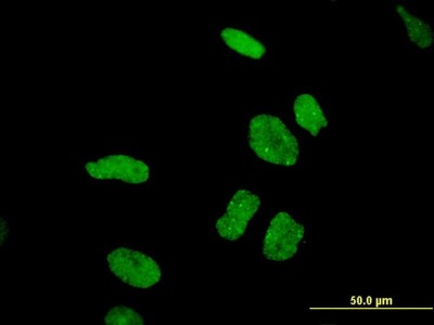 Immunocytochemistry/Immunofluorescence: DDX11 Antibody (3C1) [H00001663-M03] - Analysis of monoclonal antibody to DDX11 on HeLa cell. Antibody concentration 10 ug/ml