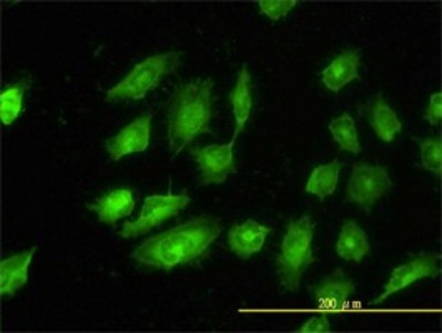 Immunocytochemistry/Immunofluorescence: tropomyosin-4 Antibody (4E4-1D2) [H00007171-M01] - Analysis of monoclonal antibody to TPM4 on HeLa cell. Antibody concentration 10 ug/ml.