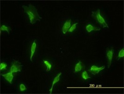 Immunocytochemistry/Immunofluorescence: GLMN Antibody (1C12) [H00011146-M01] - Analysis of monoclonal antibody to GLMN on HeLa cell. Antibody concentration 20 ug/ml.