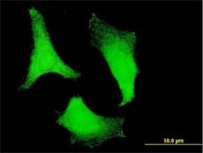 Immunocytochemistry/Immunofluorescence: RPS2 Antibody (3G6) [H00006187-M01] - Analysis of monoclonal antibody to RPS2 on HeLa cell. Antibody concentration 10 ug/ml.