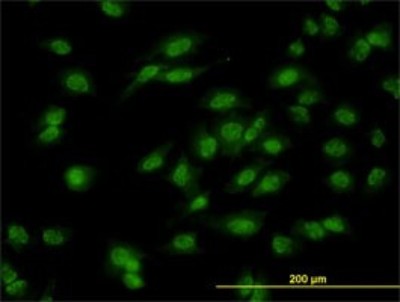 Immunocytochemistry/Immunofluorescence: Dlx1 Antibody (2H3) [H00001745-M01] - Analysis of monoclonal antibody to DLX1 on HeLa cell. Antibody concentration 10 ug/ml.