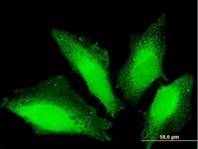 Immunocytochemistry/Immunofluorescence: TTC15 Antibody [H00051112-B01P] - Analysis of purified antibody to TTC15 on HeLa cell. (antibody concentration 10 ug/ml)