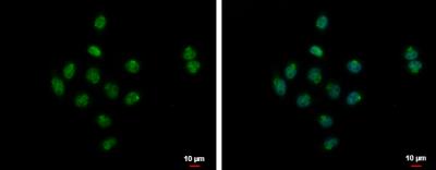 Immunocytochemistry/Immunofluorescence: SYAP1 Antibody [NBP2-20541] - SYAP1 antibody detects SYAP1 protein at nucleus and Golgi apparatus by immunofluorescent analysis. Sample: A375 cells were fixed in 4% paraformaldehyde at RT for 15 min.Green: SYAP1 protein stained by SYAP1 antibody  diluted at 1:500.Blue: Hoechst 33342 staining.Scale bar 10 um.