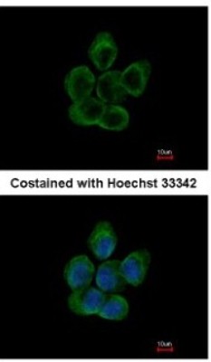 Immunocytochemistry/Immunofluorescence: Tubulin alpha-8 Antibody [NBP1-32916] - Paraformaldehyde-fixed A431, using antibody at 1:200 dilution.