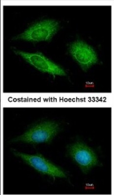Immunocytochemistry/Immunofluorescence: GTPBP9 Antibody [NBP2-16768] - Immunofluorescence analysis of methanol-fixed HeLa, using antibody at 1:200 dilution.