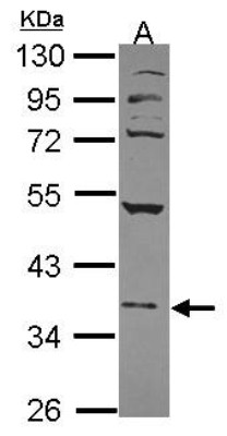 Western Blot: Nuclear Factor Erythroid Derived 2 Antibody [NBP1-31540] - Sample (30 ug of whole cell lysate) A: 293T 10% SDS PAGE; antibody diluted at 1:1000.
