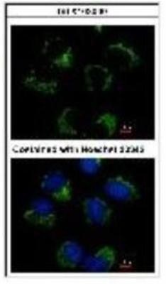 Immunocytochemistry/Immunofluorescence: CRAT Antibody [NBP1-32108] - Methanol-fixed H1299, using CRAT (NBP1-32108) antibody at 1:500 dilution.