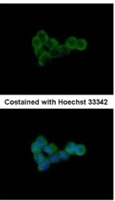 Immunocytochemistry/Immunofluorescence: DLST Antibody [NBP1-31715] - Analysis of methanol-fixed A431, using antibody at 1:500 dilution.