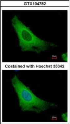 Immunocytochemistry/Immunofluorescence: ARF3 Antibody [NBP1-31004] - Immunofluorescence analysis of methanol-fixed HeLa, using ARF3 antibody at 1:500 dilution.