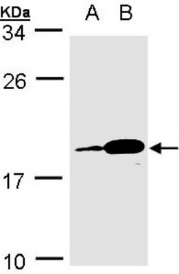 Western Blot: Proapoptotic Caspase Adaptor Protein Antibody [NBP1-31619] - Sample(30 ug whole cell lysate)A:MOLT4 B:Raji 15% SDS PAGE, antibody diluted at 1:1000.