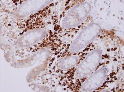 Immunohistochemistry-Paraffin: Proapoptotic Caspase Adaptor Protein Antibody [NBP1-31619] - Paraffin-embedded normal colon mucosa with lymphocyte. PACAP antibody [N1C3] dilution: 1:500.