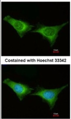 Immunocytochemistry/Immunofluorescence: PSMC6 Antibody [NBP2-19985] - Analysis of paraformaldehyde-fixed HeLa, using antibody at 1:200 dilution.