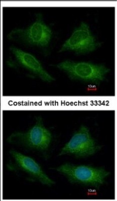 Immunocytochemistry/Immunofluorescence: ATP6V1E1 Antibody [NBP2-15520] - Immunofluorescence analysis of methanol-fixed HeLa, using antibody at 1:200 dilution.