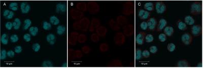 Immunocytochemistry/Immunofluorescence: CLEC3B/Tetranectin Antibody (5B7) [NBP1-05142] - For confocal microscopy, NBP1-05142 used to stain human neutrophils  A) DAPI-stained, B) tetranectin-stained, and C) overlay picture. Image courtesy of  Isabelle Naegelen, University of Luxemburg