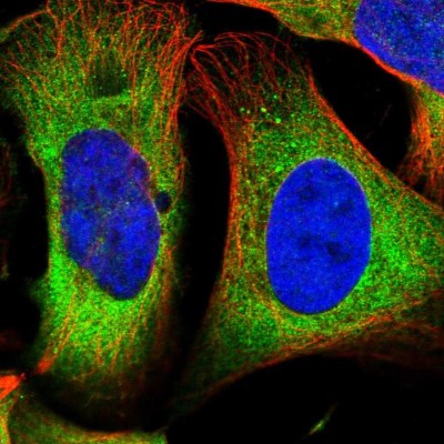 Immunocytochemistry/Immunofluorescence: DARS Antibody [NBP1-86027] - Immunofluorescent staining of human cell line U-2 OS shows localization to cytosol.