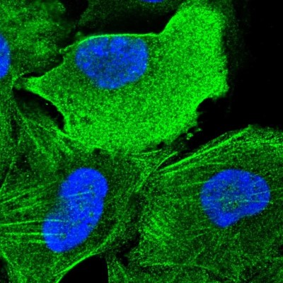Immunocytochemistry/Immunofluorescence: SLC46A3 Antibody [NBP1-85054] - Immunofluorescent staining of human cell line U-2 OS shows localization to plasma membrane, cytosol & actin filaments.