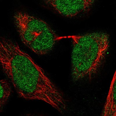 Immunocytochemistry/Immunofluorescence: RPC62 Antibody [NBP1-87110] - Immunofluorescent staining of human cell line U-2 OS shows localization to nucleoplasm.