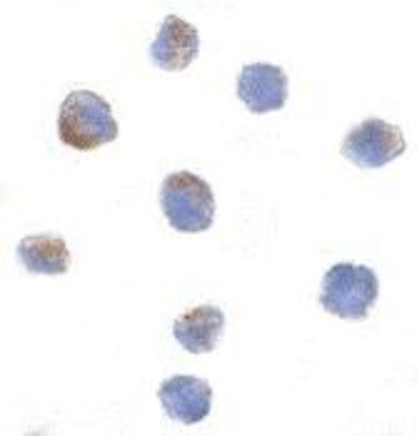 Immunocytochemistry/Immunofluorescence: PARC Antibody [NBP1-77222] - Daudi cells with PARC antibody at 1 ug/ml.