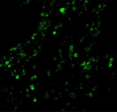 Immunocytochemistry/Immunofluorescence: cIAP-1/HIAP-2 Antibody [NBP1-77193] - Human Lung cells with cIAP-1/HIAP-2 antibody at 20ug/ml
