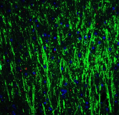 Immunocytochemistry/Immunofluorescence: DCLK3 Antibody [NBP1-77129] - Staining of DCLK3 in mouse brain tissue with DCLK3 Antibodyat 20 ug/mL.