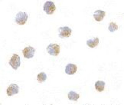 Immunocytochemistry/Immunofluorescence: ATF6 Antibody [NBP1-77251] - A20 with ATF6 antibody at 10 ug/ml.