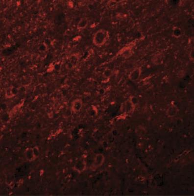 Immunocytochemistry/Immunofluorescence: Synaptogyrin 2 Antibody [NBP1-77101] - Immunofluorescence of SYNGR2 in rat brain tissue with SYNGR2 antibody at 20 ug/mL.
