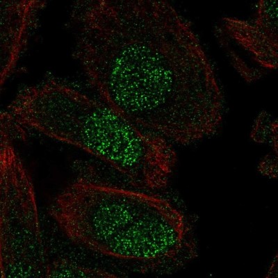 Immunocytochemistry/Immunofluorescence: SP8 Antibody [NBP2-49109] - Staining of human cell line PC-3 shows localization to nucleus.